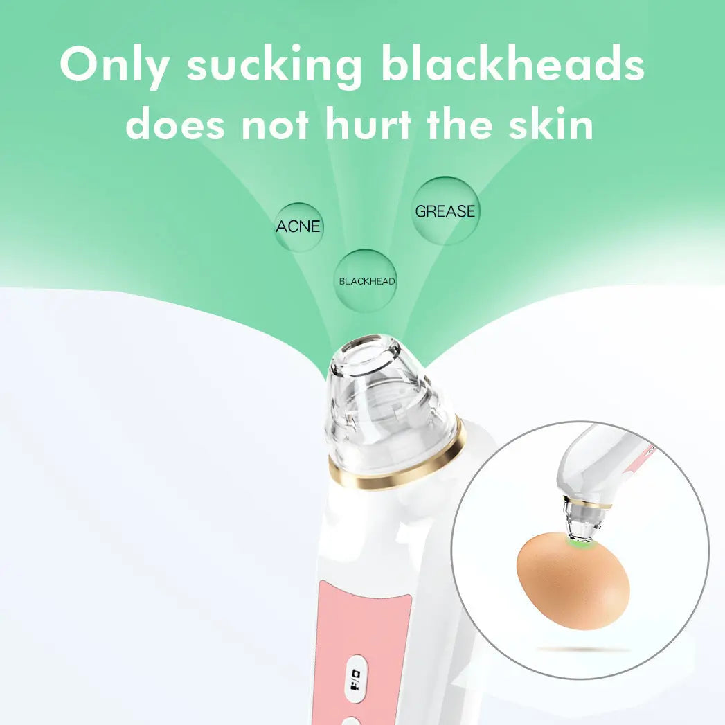 High Definition Visual Electric Blackhead Absorber – HD Visual Electric Blackhead Remover