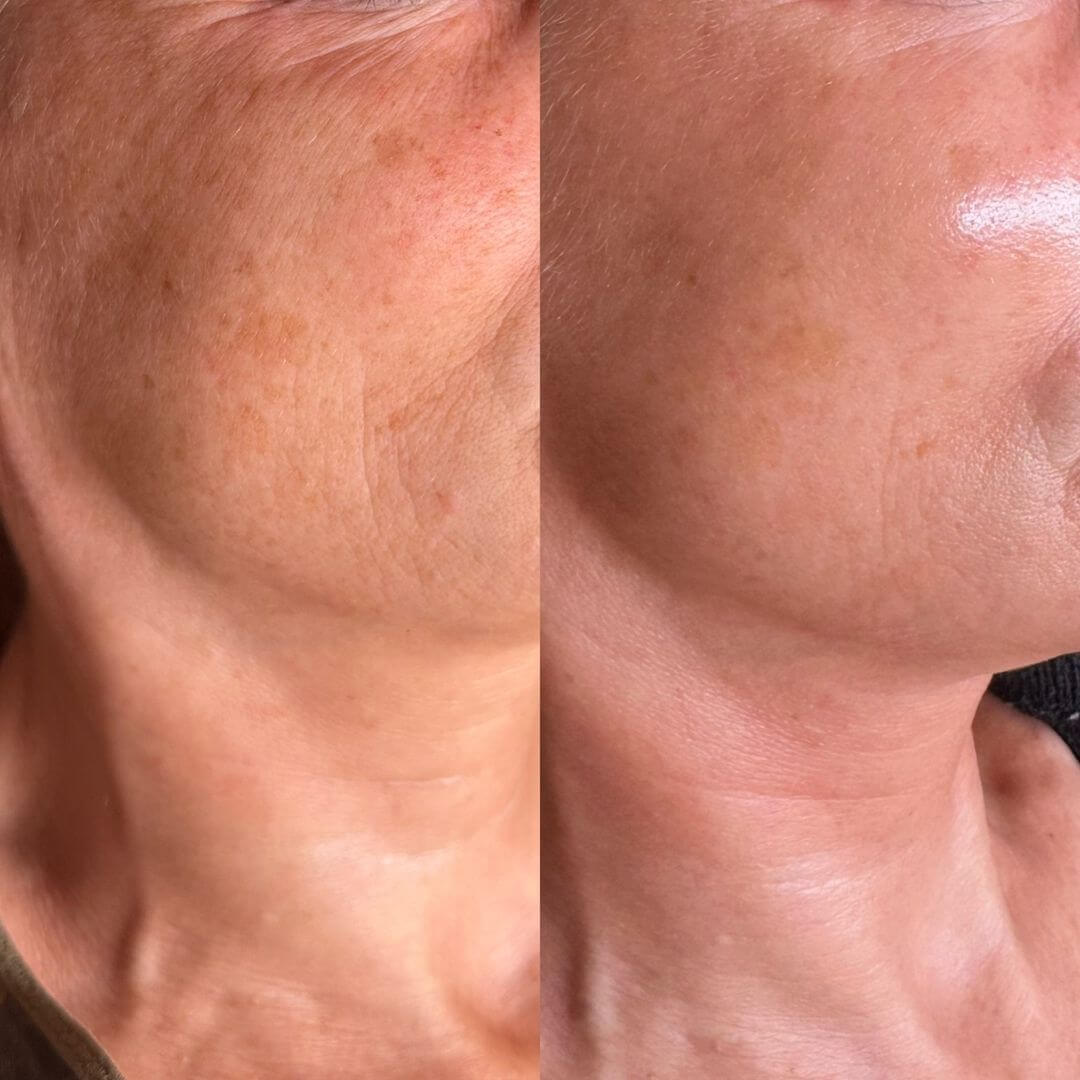 Elixir Serum - 24kGold Ginseng Root Niacinamide Vitamin C Skynflow