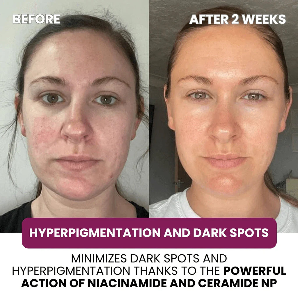 Collagen & Niacinamide wrapping mask - Sunnyside Beauty