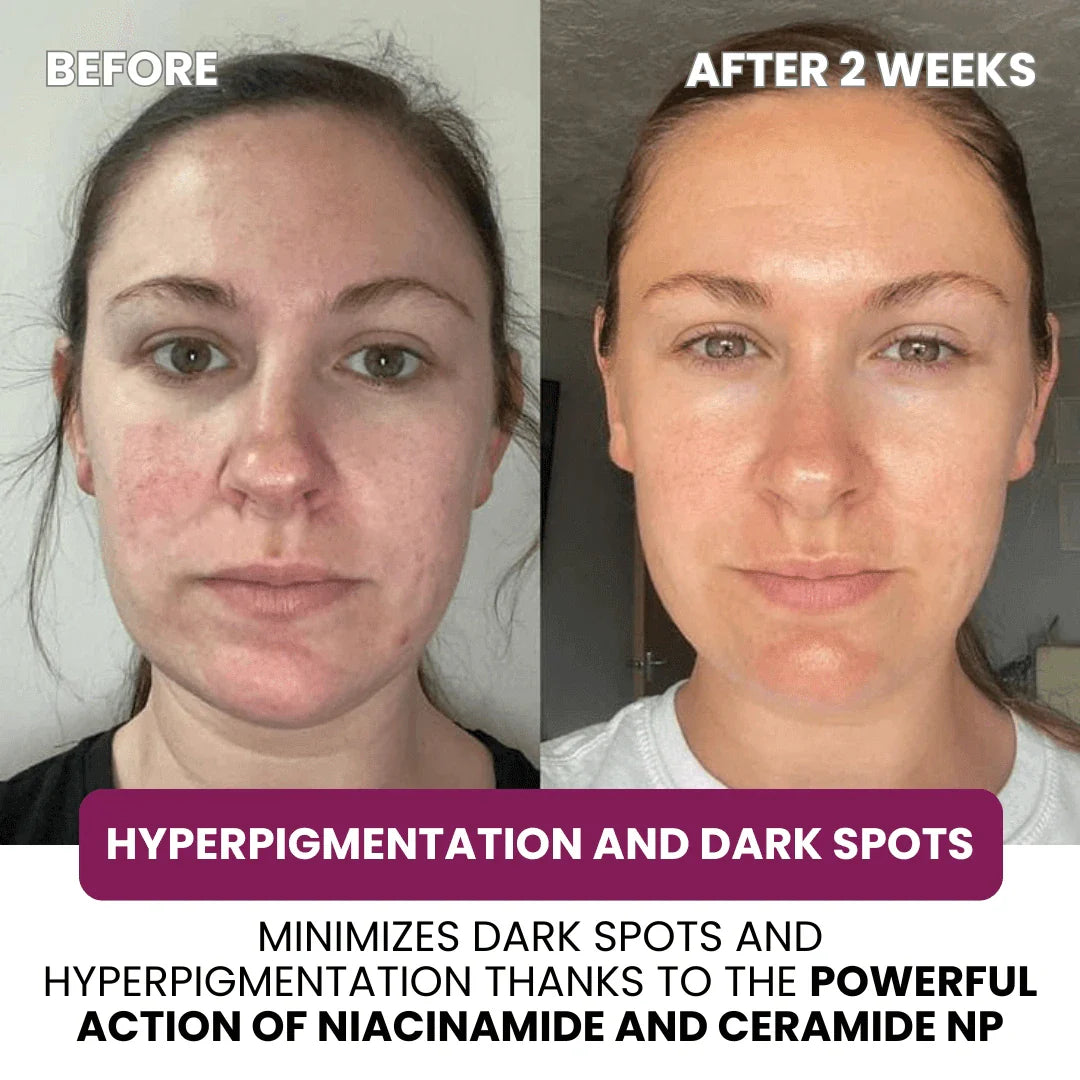 Collagen & Niacinamide wrapping mask - Sunnyside Beauty