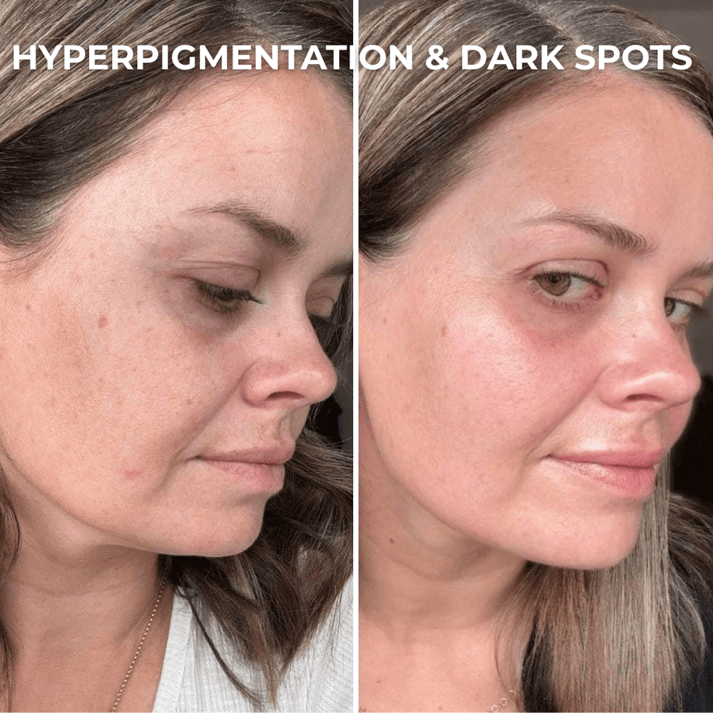 PDRN Collagen Peptide Hydrogel Mask - Sunnyside Beauty