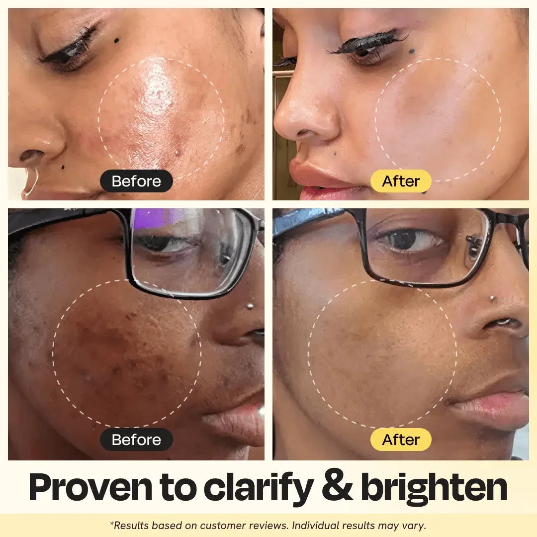 Vitamin C Clay Mask – Brightening & Detoxifying Clay Mask