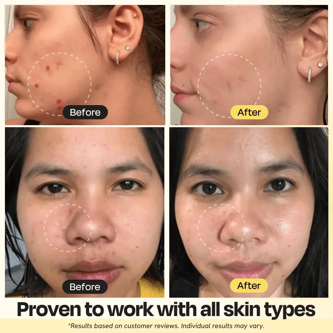 Vitamin C Clay Mask – Brightening & Detoxifying Clay Mask