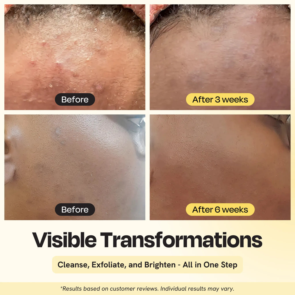 Clarifying Brightening Cleanser – Gentle Brightening Daily Cleanser