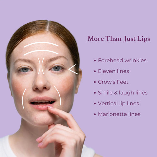 Ageless Lip & Line Filler – Anti-Aging Lip & Line Filler Treatment