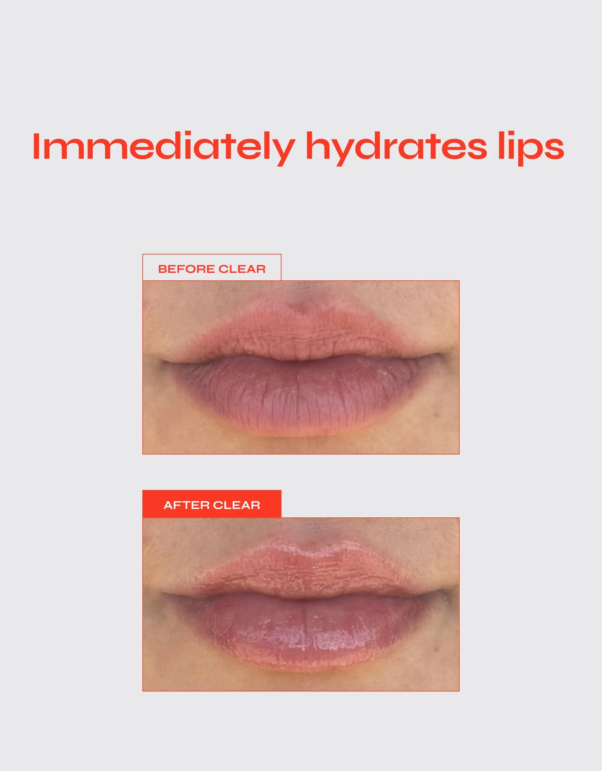 Lip Jelly – Hydrating Glossy Lip Jelly to