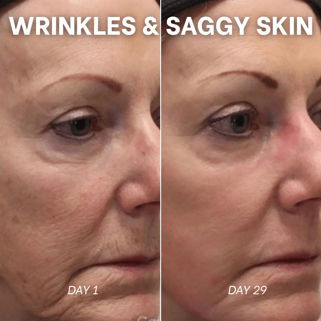PDRN Collagen Peptide Hydrogel Mask - Sunnyside Beauty