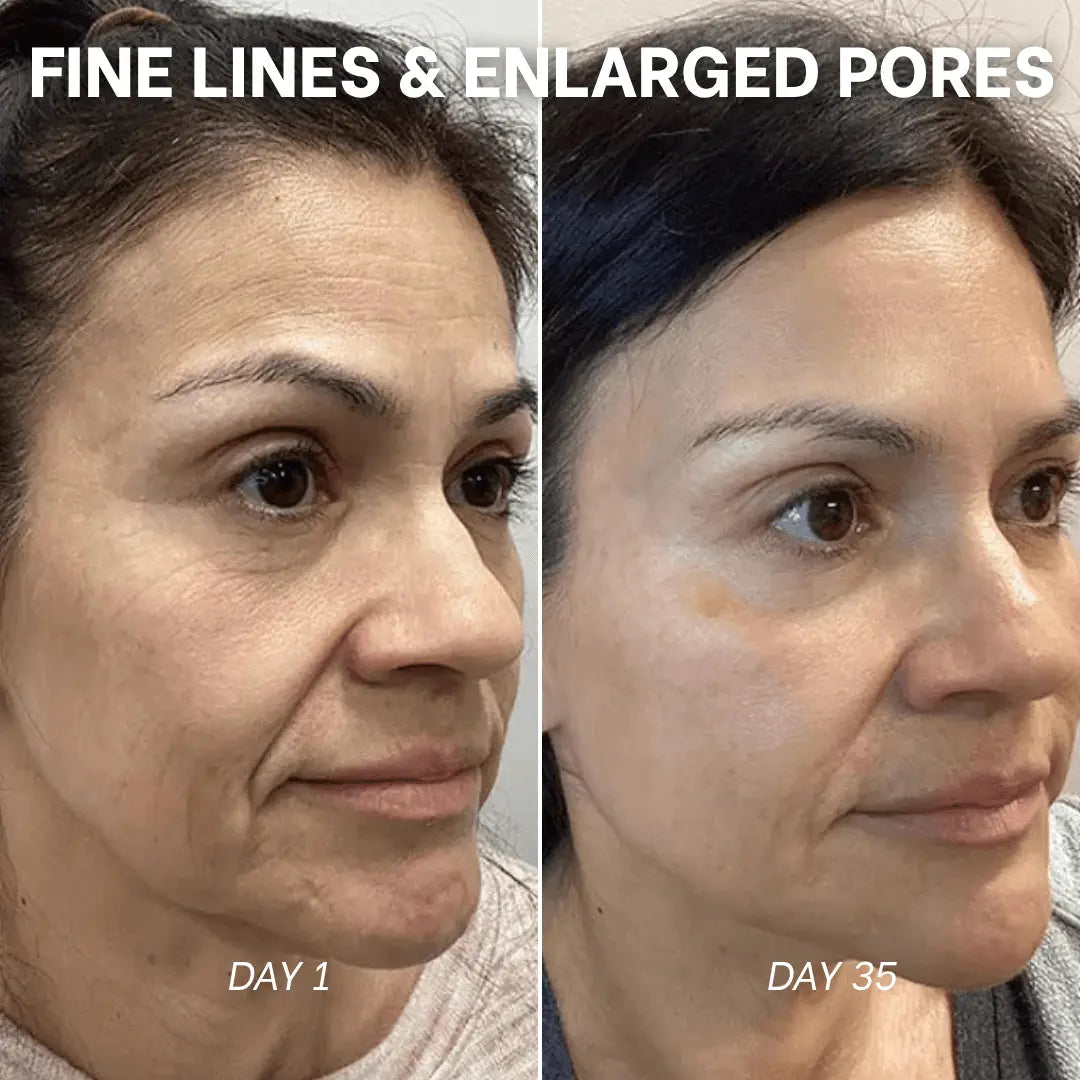PDRN Collagen Peptide Hydrogel Mask Skynflow