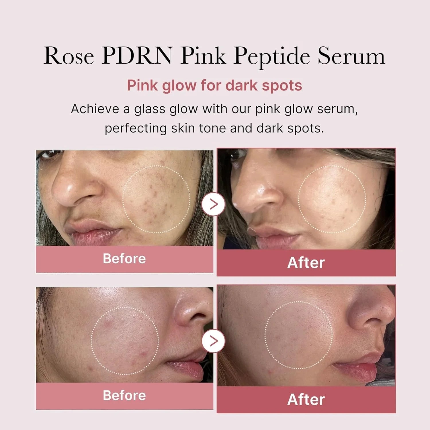 Plumping Serum - Peptides PDRN Niacinamide Retinol Skynflow